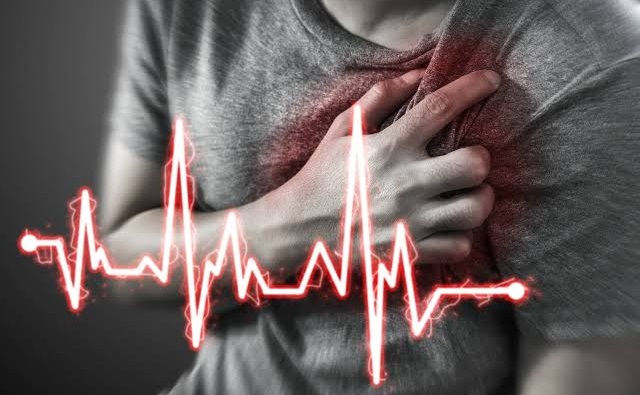 Cardiac Arrest